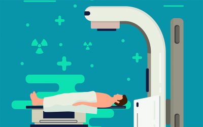 La radioterapia en España: costes asociados y ayudas a tener en cuenta