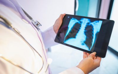 Avanzando en un método de detección precoz del cáncer de pulmón