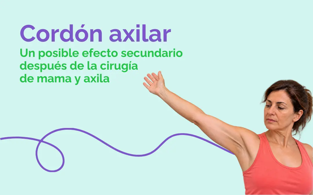 Cordón axilar: un posible efecto secundario después de la cirugía de mama y axila
